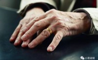 【“爷爷戴了50年的戒指已经摘不掉了”：这些照片，让人唏嘘不已！】